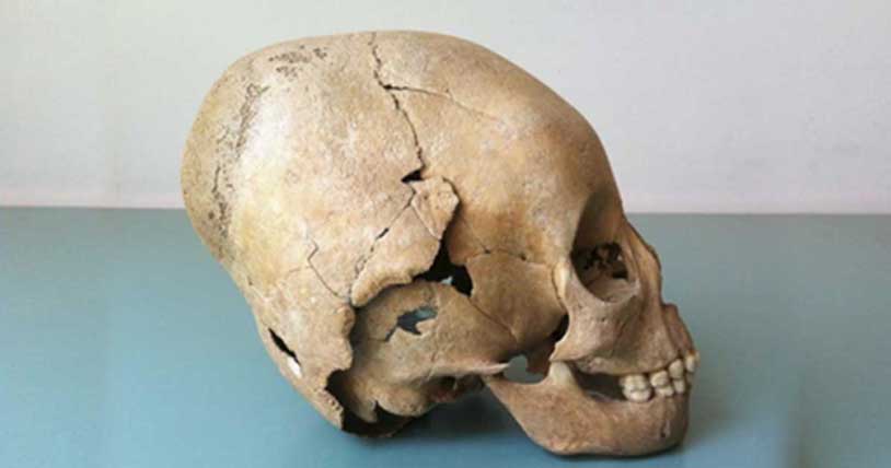 Ejemplo de un cráneo modificado, práctica originaria supuestamente de los hunos que podría haber sido adoptada por los campesinos locales. (Susanne Hakenbeck)