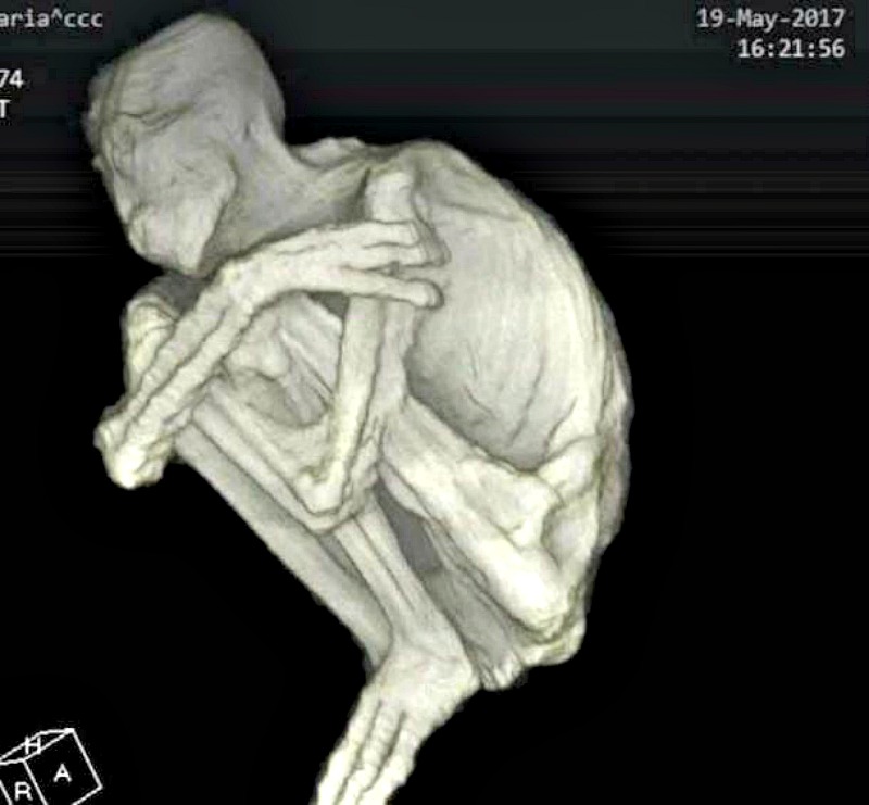 Imagen de la “momia extraterrestre” de Nazca obtenida mediante tomografía computarizada (Youtube)