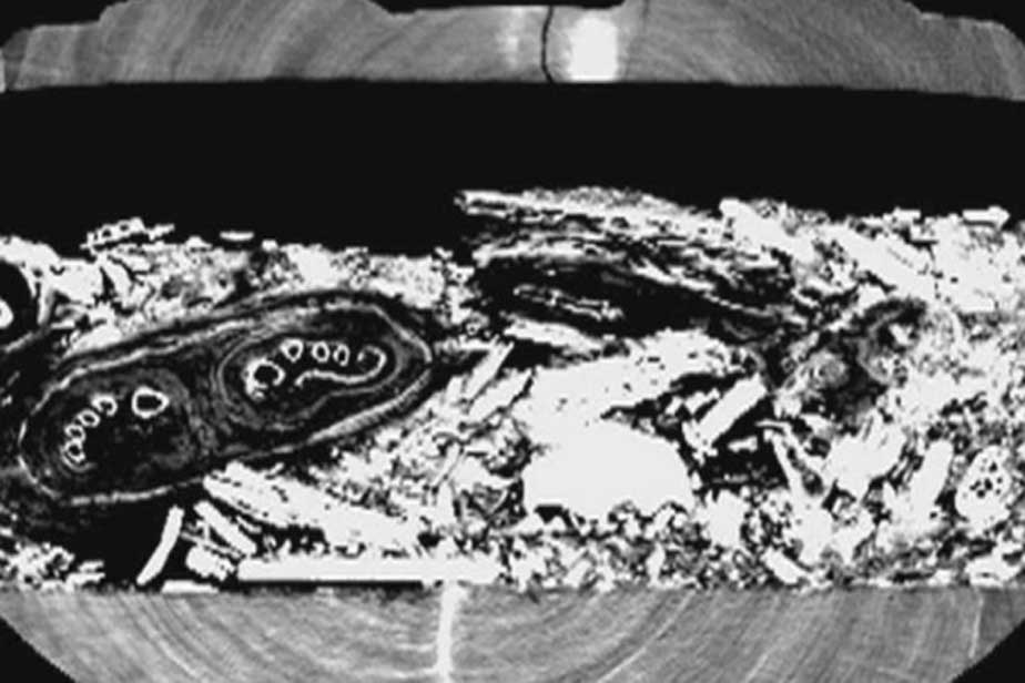Imagen de la tomografía computarizada en la que se observan los pies de la momia. (ABC News)