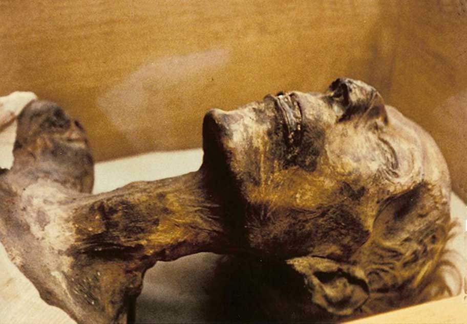Un examen de la momia de Ramsés II realizado en la década de 1970 reveló la presencia de fragmentos de hojas de tabaco dentro de su abdomen. (CC BY SA 3.0)