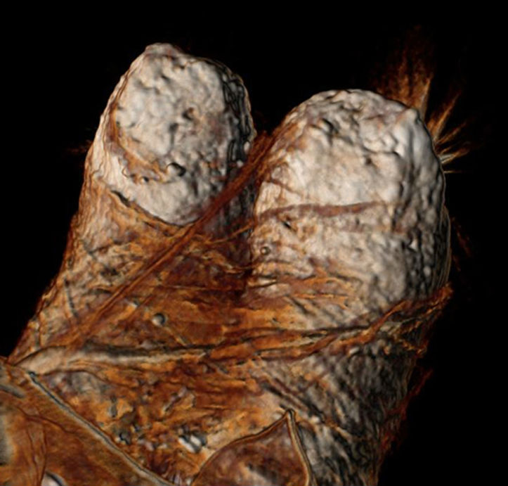 Imagen del escaneo tridimensional mediante tomografía computadorizada de los pies de Ramsés III, en la que se observan los gruesos vendajes de lino empleados en su momificación. (Sahar Saleem y Zahi Hawass) 