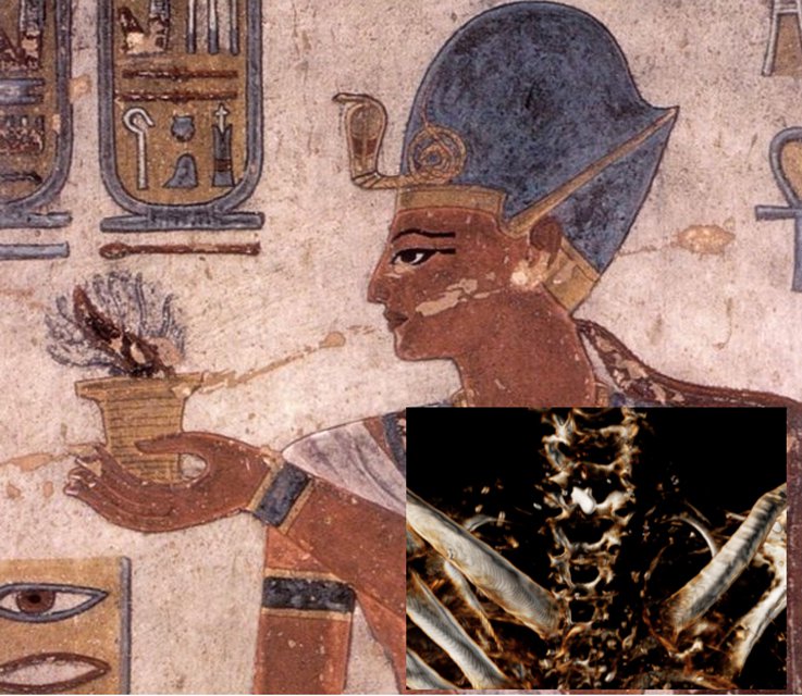 Portada-Ramsés III ofrece incienso, pintura mural de la tumba KV11. (Public Domain) Detalle: Imagen de tomografía computadorizada en la que se observa la herida en el cuello de Ramsés III infligida por una hoja afilada, así como el amuleto colocado en su interior para ayudar a su curación. (Sahar Saleem)