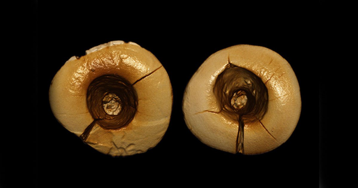 Portada - Fotografía de los dos antiguos dientes empastados con betún hace 13.000 años. (Stefano Benazzi)