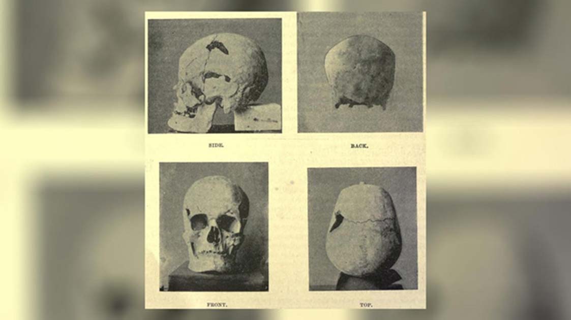 Portada - Cráneo del faraón egipcio Sa-Nakht, quien probablemente sufriera gigantismo (Dominio público)