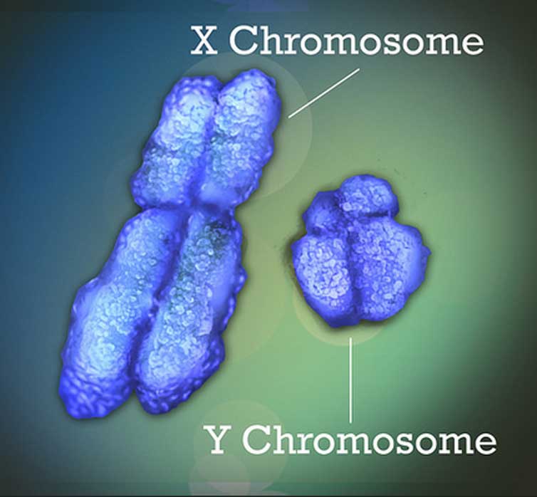 Los cromosomas X e Y, tambiÃ©n conocidos como cromosomas sexuales. (NIH Image Gallery)