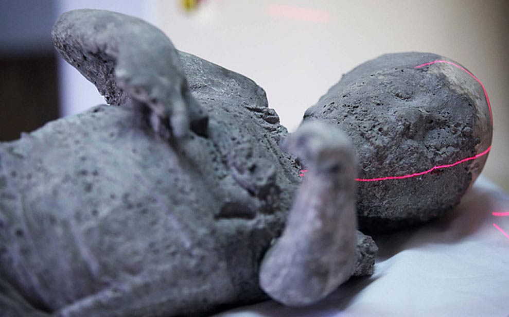 Portada-Molde de yeso que contiene los restos de un niño de cuatro años víctima de la erupción del Vesubio, en el momento de ser introducido en el aparato de Tomografía Computadorizada. Italia (Autoría: Photoshot) 