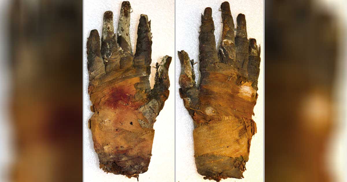 Portada - FotografÃ­a de la mano humana momificada de un hombre del antiguo Egipto recientemente escaneada en Suecia. A la izquierda la palma, a la derecha el dorso. Fuente: Sociedad RadiolÃ³gica de NorteamÃ©rica / Radiology