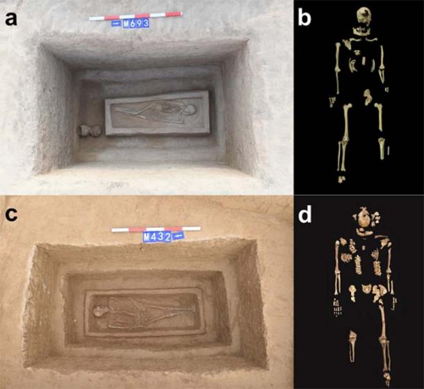Los dos entierros y los esqueletos amputados encontrados en su interior. (Wang, Q. et al/Ciencias Arqueológicas y Antropológicas)