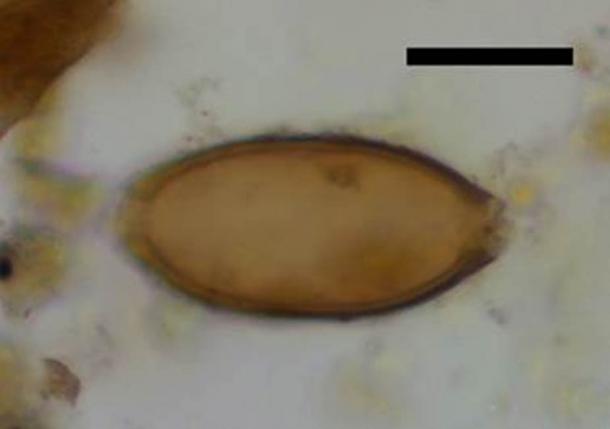 Huevo microscópico de látigo de Çatalhöyük, Turquía. La barra de escala negra representa 20 micrómetros. (Evilena Anastasiou)