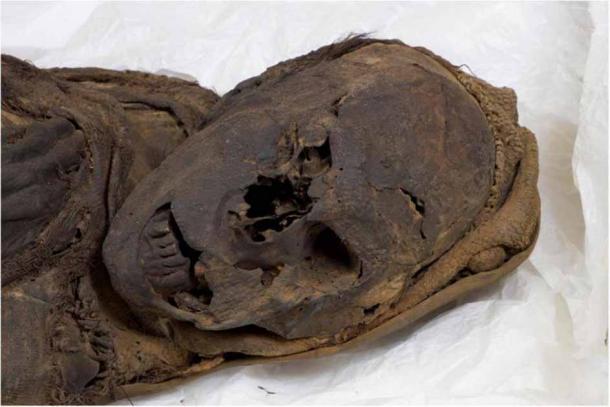 La momia masculina de Delémont: vista de la cara y aspectos de la mitad superior del cuerpo desde el lado derecho. (Begerock et al. 2022/ Frontiers in Medicine)