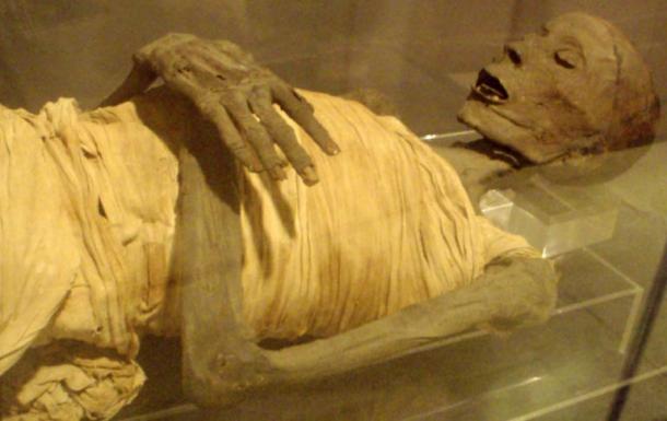 El Misterio Médico De Usermontu: ¿Por Qué El Descubrimiento De Un Tornillo En Una Rótula De 2600 Años Dejó Perplejos A Los Expertos? Mummified-remains-Usermontu